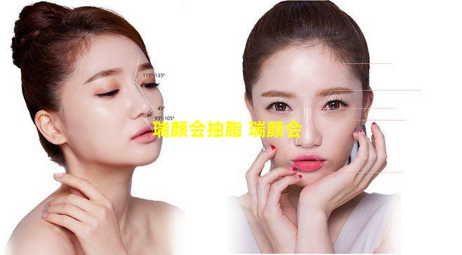 瑞颜会抽脂 瑞颜会
